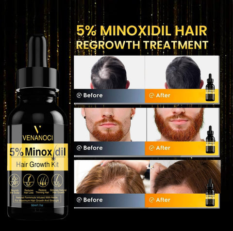 5% Minoxidil Hair Growth Serum, 5% Minoxidil For Men Beard Growth Kit, Beard Growth Oil With Biotin & Caffeine For Beard & Hair Growth, Grow A Stronger Thicker Fuller Hair & Beard Faster 1.7oz